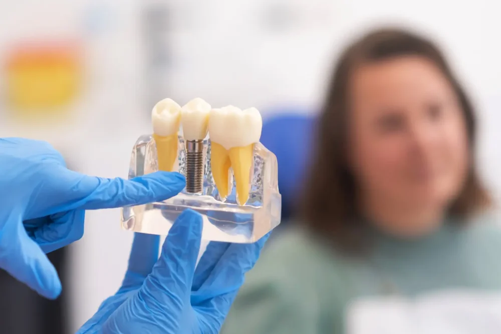 Dimostrazione modelli dentali