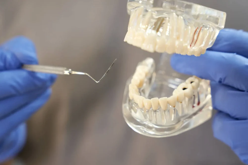 Dental tools and model demonstration