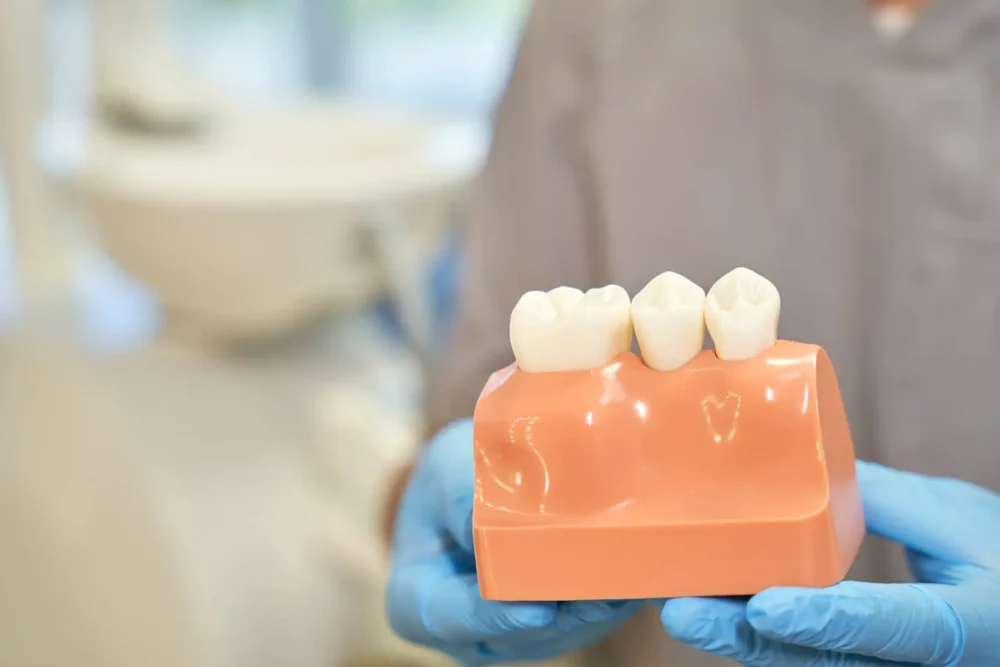 Modello dentale in mano a medico