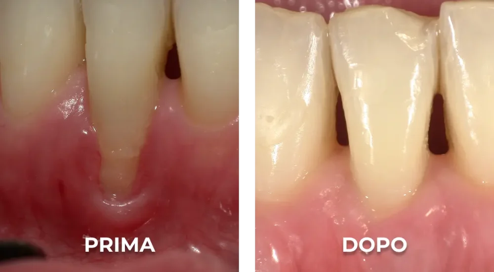 Confronto dentale: prima e dopo
