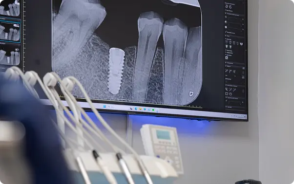 Schermo radiografia e strumenti odontoiatrici