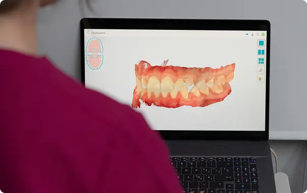 Dentista analizza denti su schermo