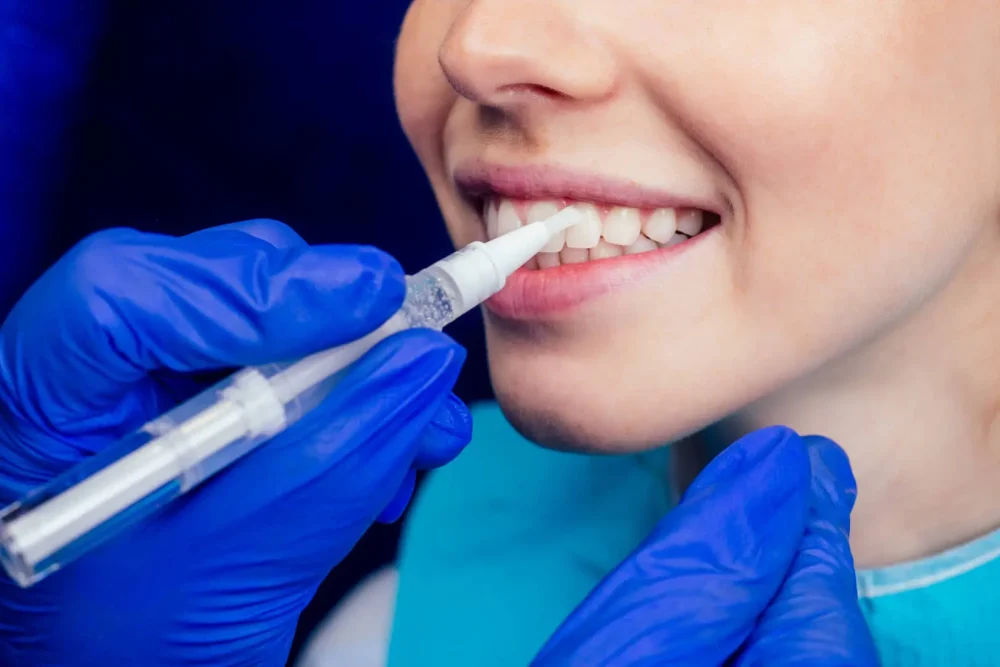 Dentista esegue trattamento dentale delicato