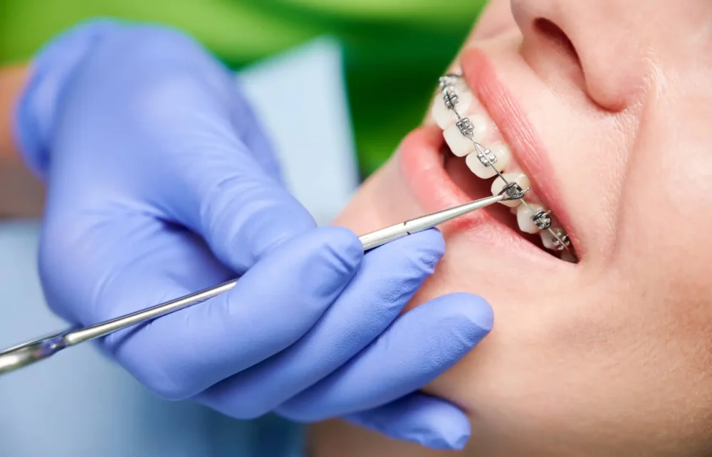 Paziente con apparecchio ortodontico in cura